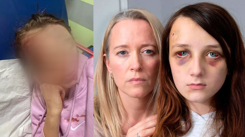  Mother of Assaulted Autistic Girl Urges Stricter Regulations on Social Media Platforms